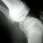picture of xray for rollerderbytape.com